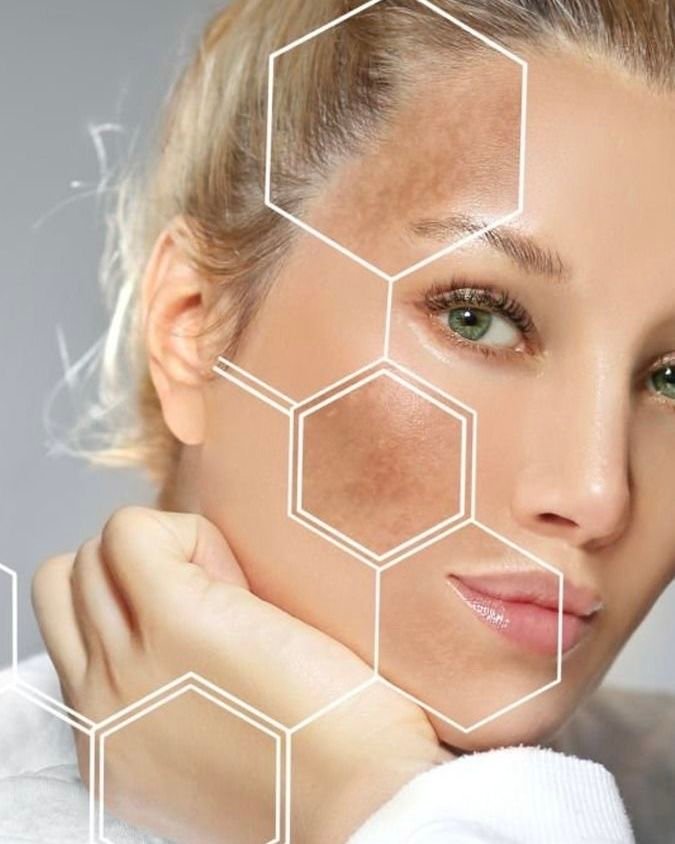 علاج البشرة الباهتة