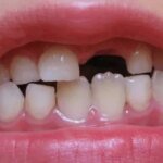 maxresdefault 4 11719103647