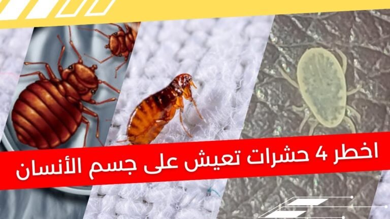كل ما تحتاج لمعرفته عن رؤية الحشرات على جسمك