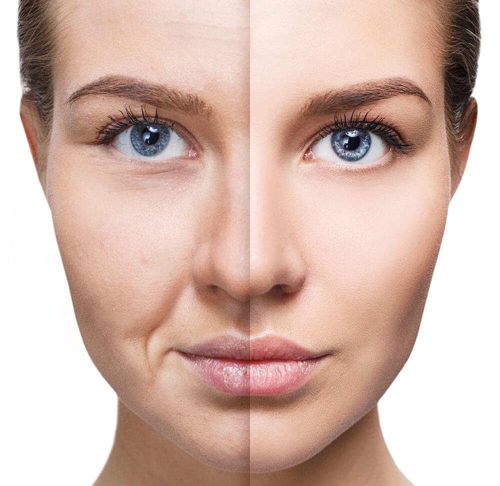 وصفات للعناية بالبشرة