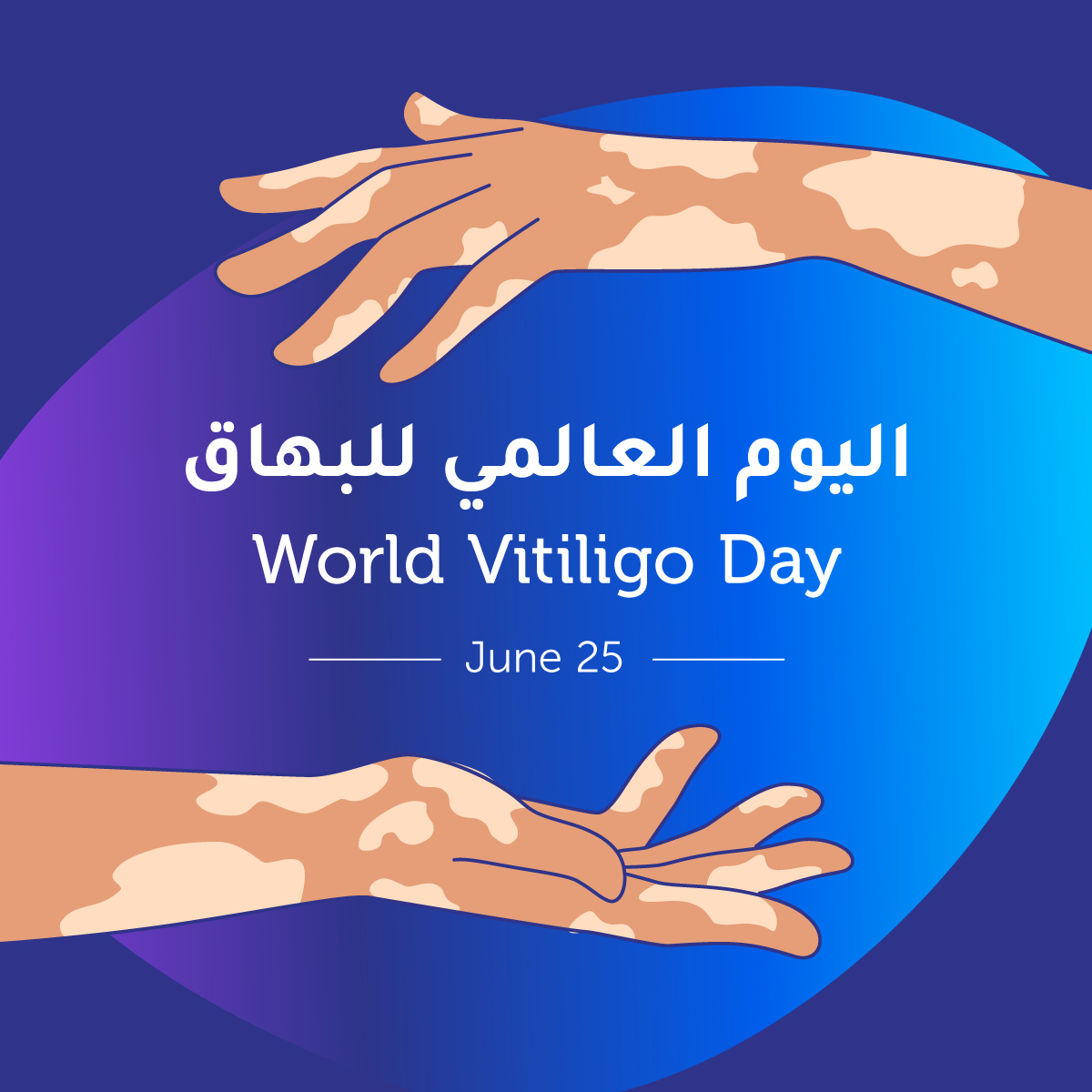البهاق